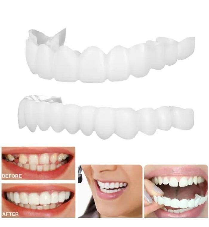 Teeth Brace Temporary Teeth Braces Cover - NovaMart