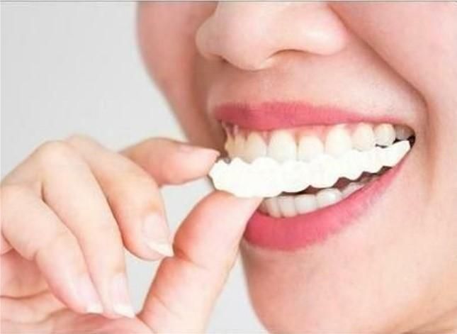 Teeth Brace Temporary Teeth Braces Cover - NovaMart