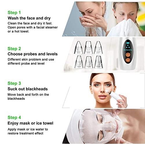 Remove Blackhead Device - NovaMart