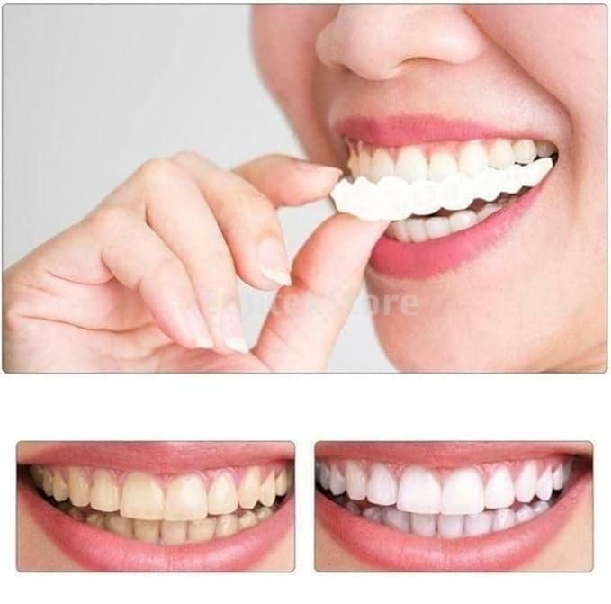 Teeth Brace Temporary Teeth Braces Cover - NovaMart